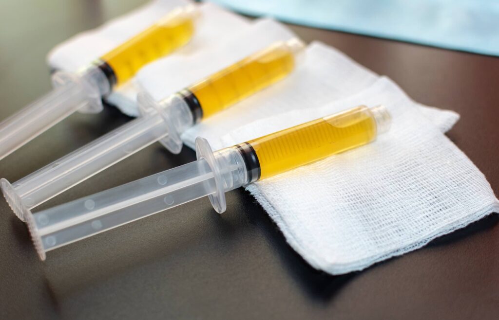 Orthopedic PRP Therapy Syringes