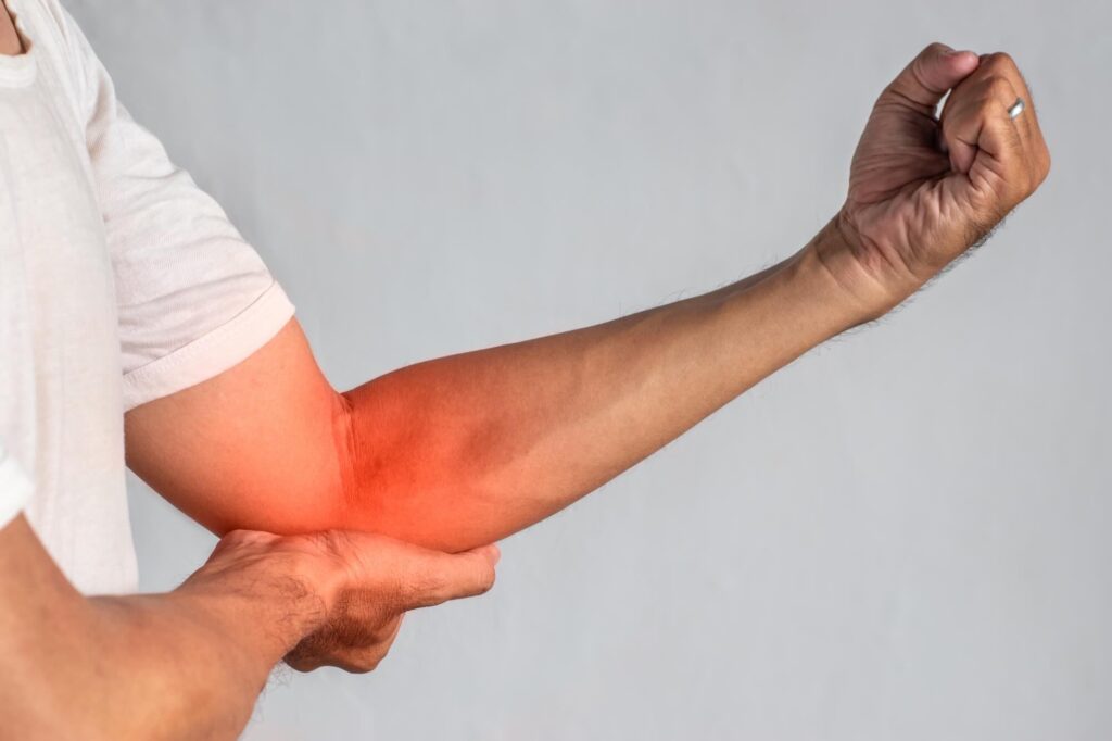 Man with pain due to Cubital Tunnel Syndrome