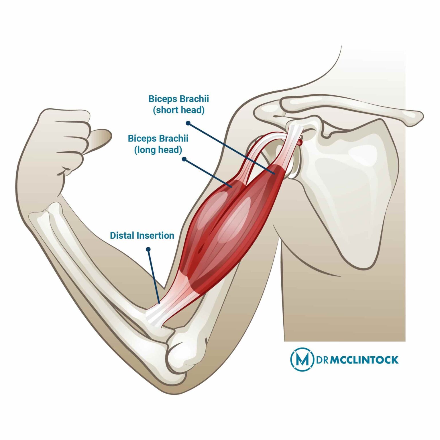 understanding-bicep-tendonitis-kyle-mcclintock-do-orthopedic