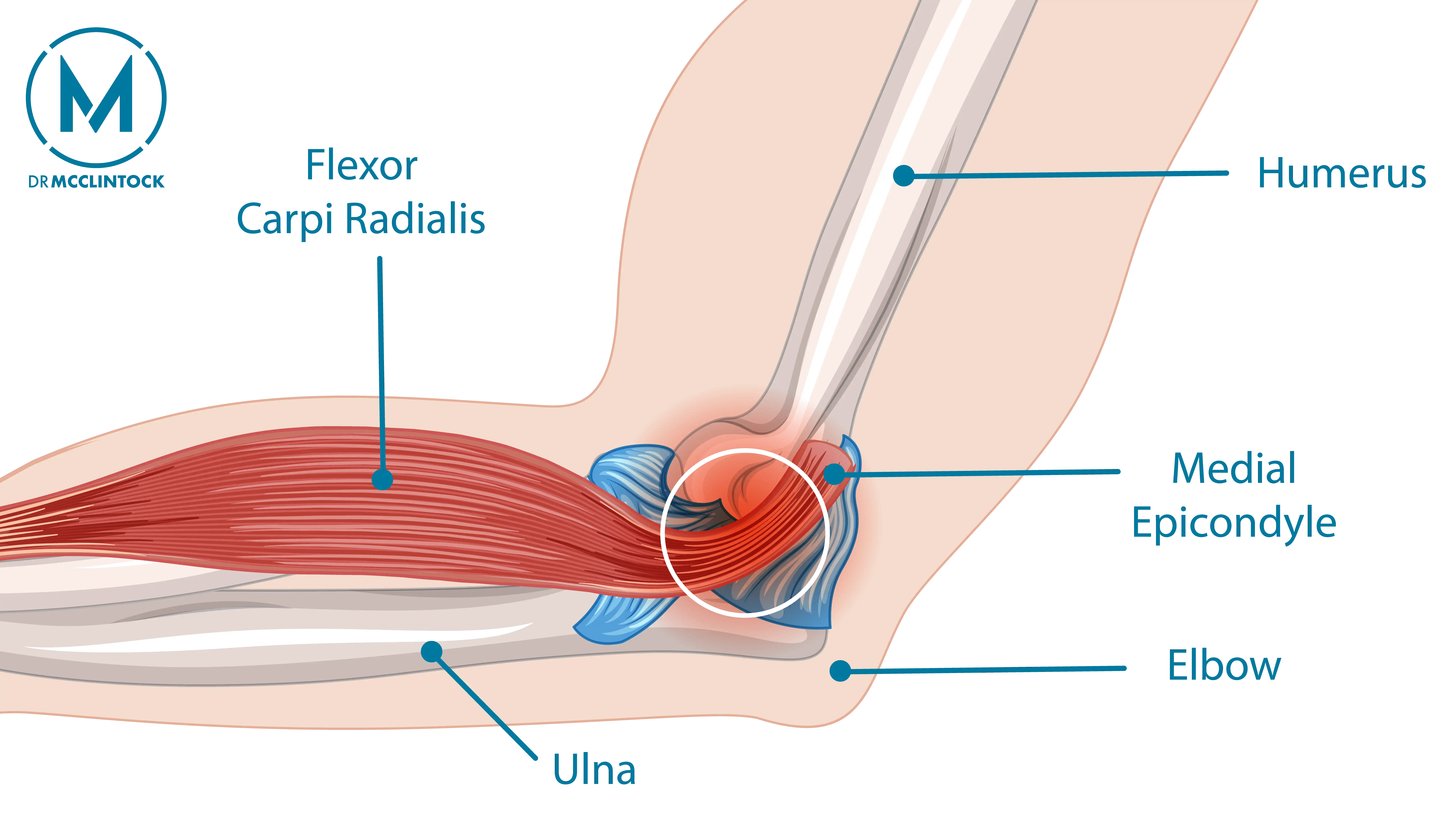 Anatomical Graphic of Pitchers Elbow