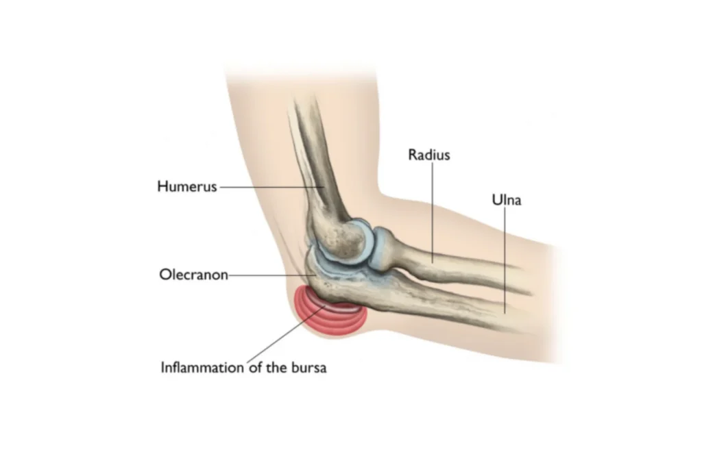 Gout Elbow Anatomy