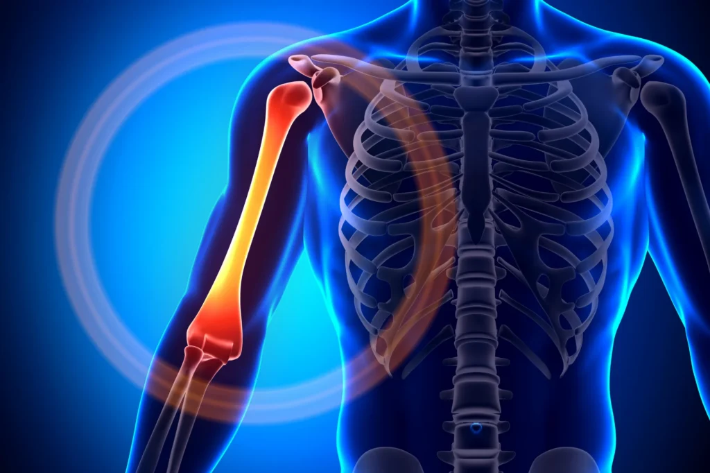 Shoulder bone contusion