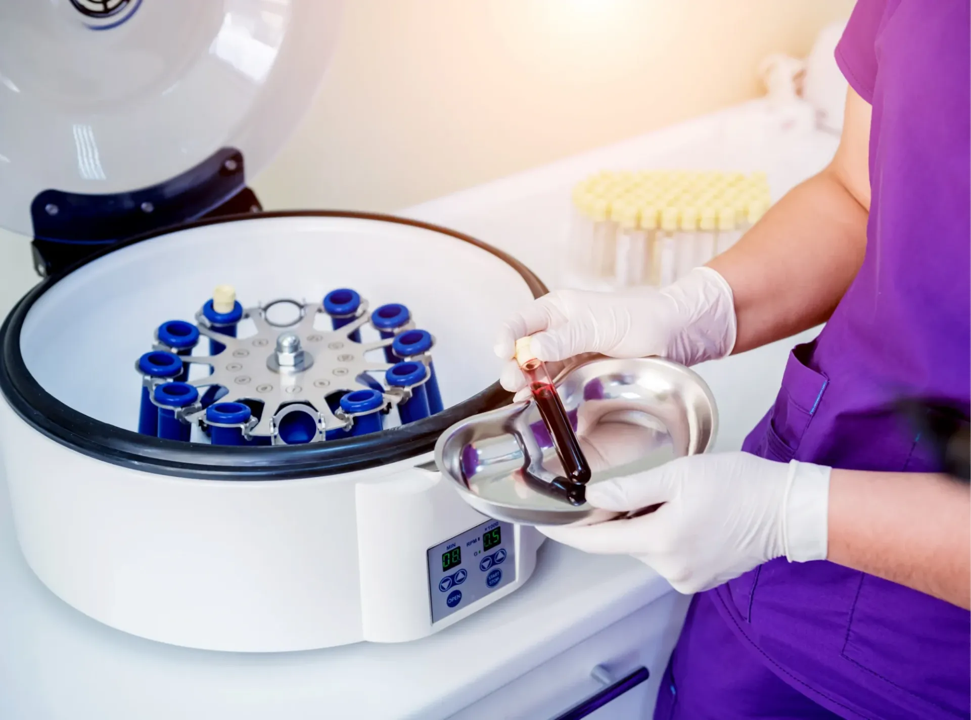 platelet-rich plasma (PRP) therapy injection preparation